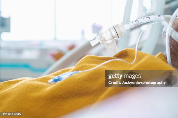 endotrachel tube giving oxygen to illness human - ventilator stock pictures, royalty-free photos & images