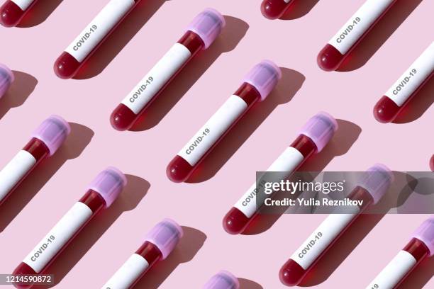 covid-19 test tubes on the pink background - blood tubes stock pictures, royalty-free photos & images