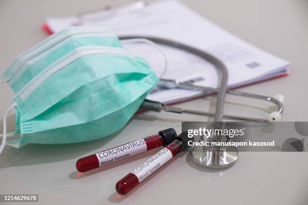 coronavirus blood sample,health care, blood test,blood research - totenmaske stock-fotos und bilder