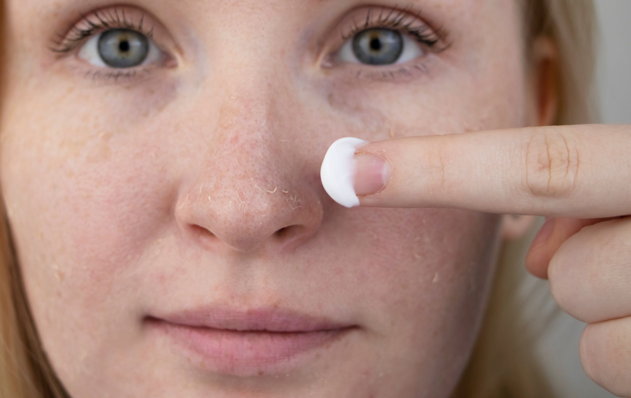 dry skin care
