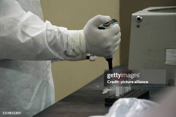 Dpatop - 21 May 2020, Egypt, Giza: A picture made available on 23 May 2020 shows a medic analysing swabs taken from patients suspected to have...