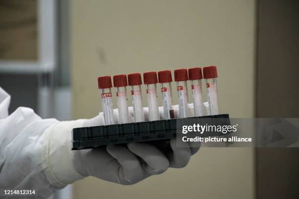 May 2020, Egypt, Giza: A picture made available on 23 May 2020 shows a medic analysing swabs taken from patients suspected to have contracted...