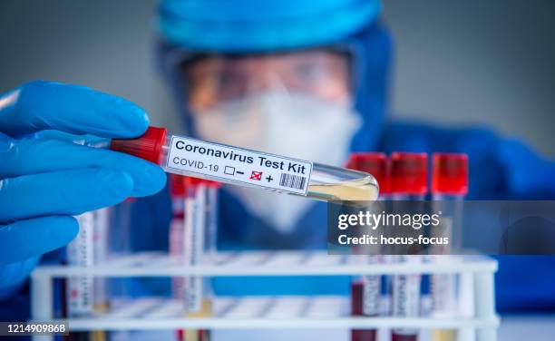 examining coronavirus covid 19 medical samples on kits novel corona virus outbreak - testing kit stock pictures, royalty-free photos & images
