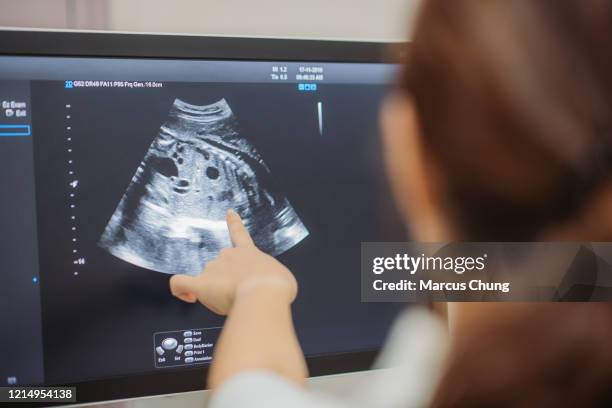 primer plano del joven médico chino asiático que muestra una ecografía en el monitor a la mujer embarazada en la habitación del médico en el hospital - ecografía fotografías e imágenes de stock