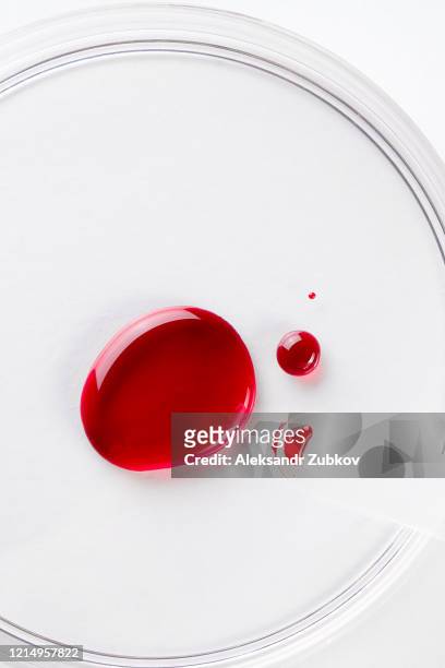 a drop of blood in a glass petri dish . - sangue umano foto e immagini stock
