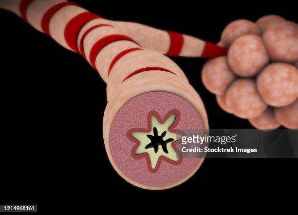 medical illustration of an asthmatic bronchiole. - mucus stock illustrations