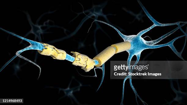 illustrazioni stock, clip art, cartoni animati e icone di tendenza di conceptual image of a multiple sclerosis neuron. - sistema nervoso centrale