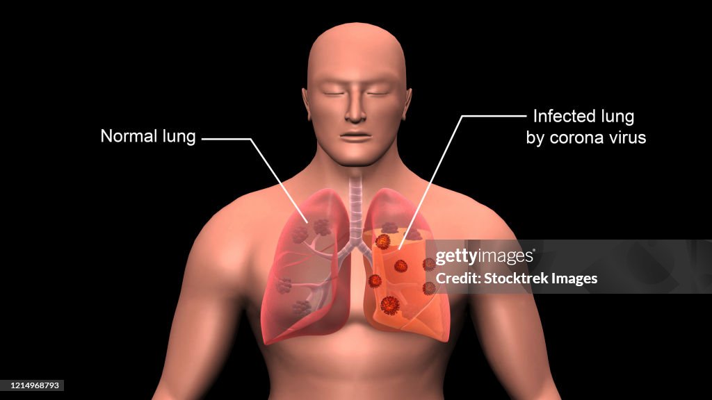 COVID-19 coronavirus infecting the human lungs, with labels.