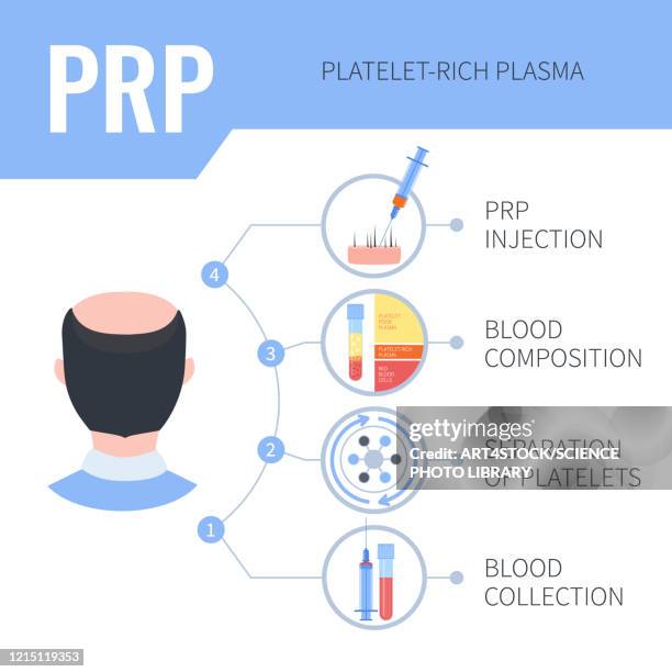 prp hair regrowth therapy in men, illustration - alternative therapy stock illustrations
