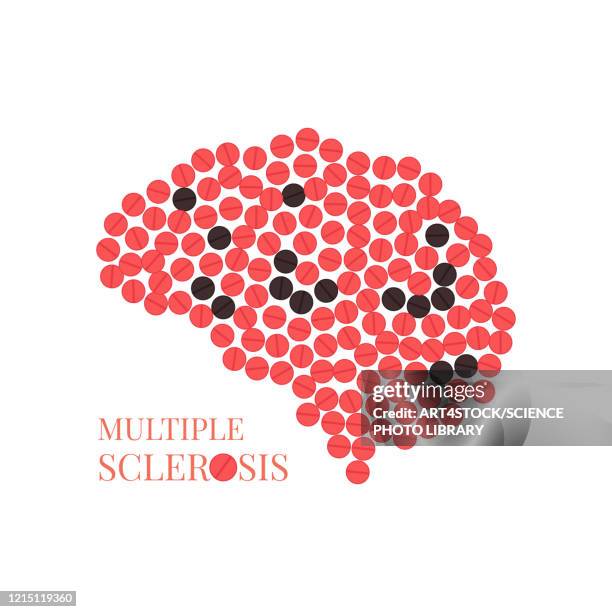multiple sclerosis, conceptual illustration - science stock illustrations stock-grafiken, -clipart, -cartoons und -symbole