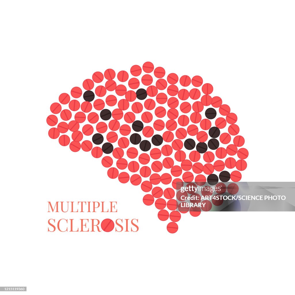 Multiple sclerosis, conceptual illustration