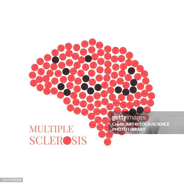 illustrazioni stock, clip art, cartoni animati e icone di tendenza di multiple sclerosis, conceptual illustration - sclerosis