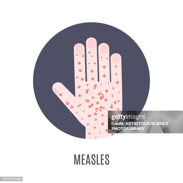 measles awareness, illustration - hautkrankheiten stock-grafiken, -clipart, -cartoons und -symbole