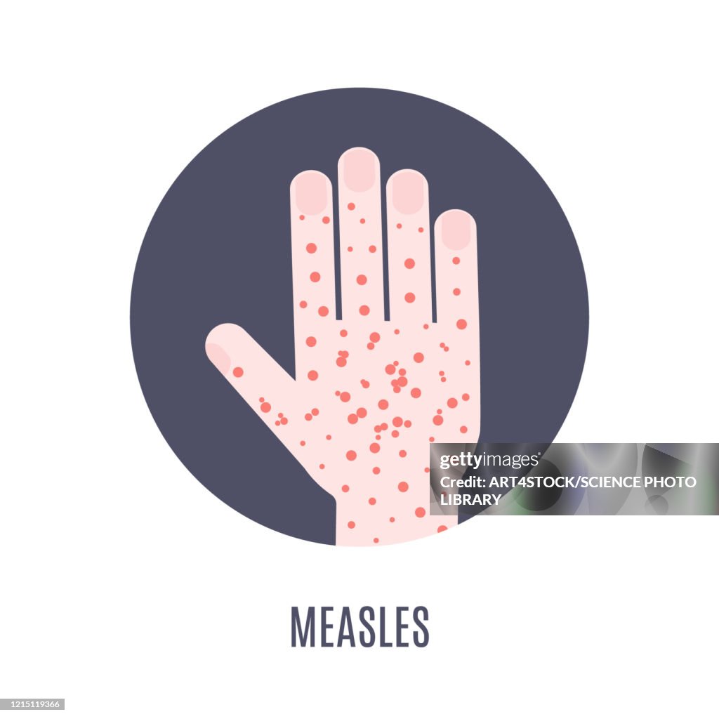 Measles awareness, illustration