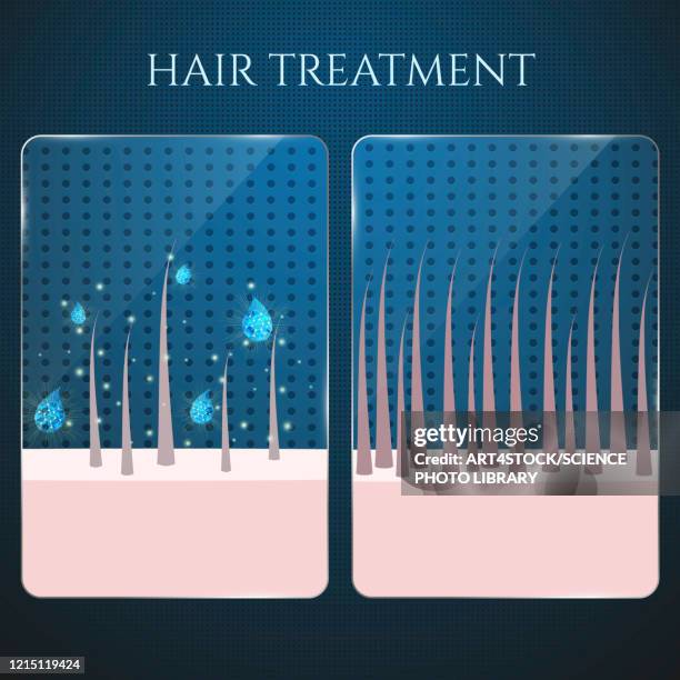 hair follicle treatment, illustration - human skin texture background stock illustrations