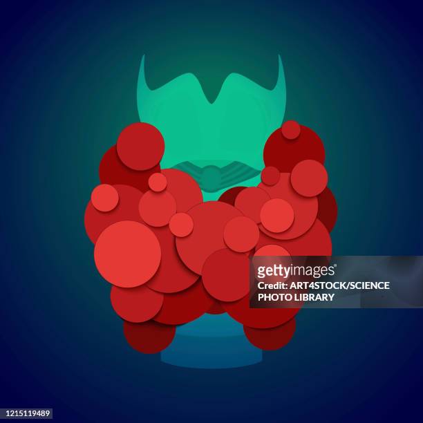thyroid gland, conceptual illustration - thyroid gland stock-grafiken, -clipart, -cartoons und -symbole