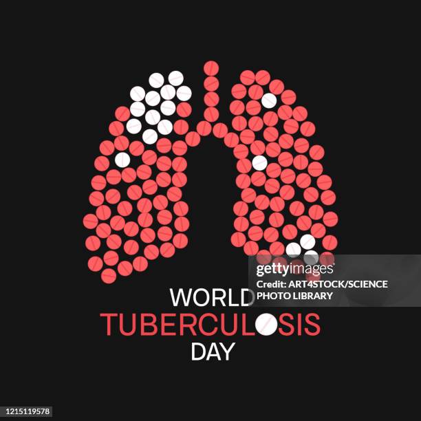 illustrazioni stock, clip art, cartoni animati e icone di tendenza di tuberculosis, conceptual illustration - tuberculosis
