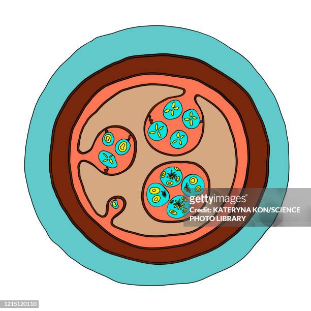echinococcus granulosus hydatid cyst, illustration - taenia saginata stock illustrations