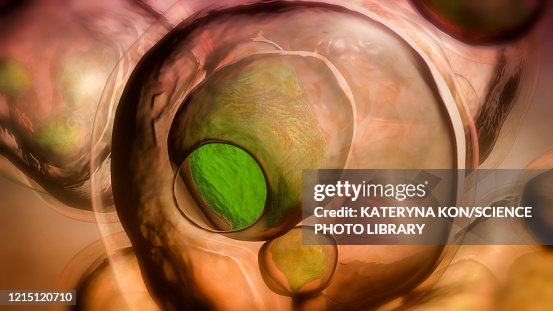 Echinococcus multilocularis hydatid cyst, illustration Echinococcus multilocularis hydatid cyst, illustration