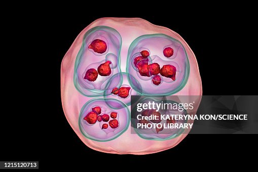 Echinococcus multilocularis hydatid cyst, illustration Echinococcus multilocularis hydatid cyst, illustration