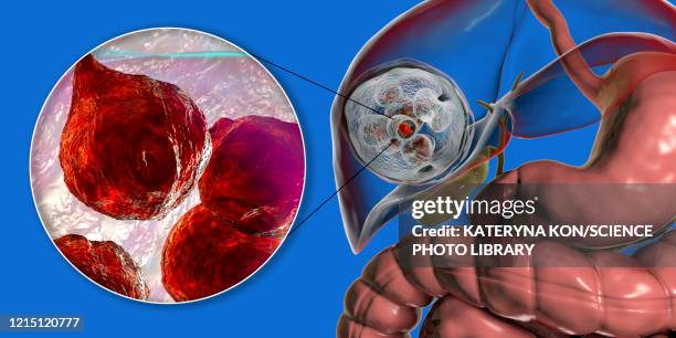 hydatid disease in liver, cystic echinococcosis, illustratio - dog tapeworm stock illustrations