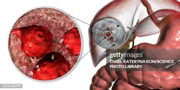 hydatid disease in liver, cystic echinococcosis, illustratio - dog tapeworm stock illustrations