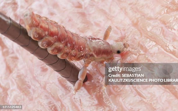 head louse, illustration - nit comb stock illustrations