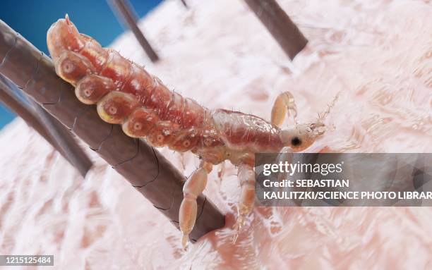 head louse, illustration - hair macro stock illustrations