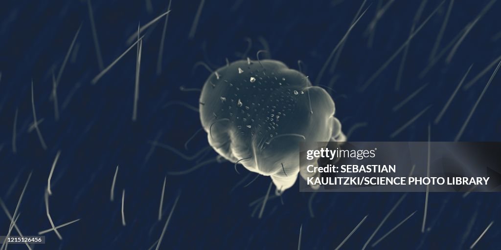 Scabies mite on human skin, illustration