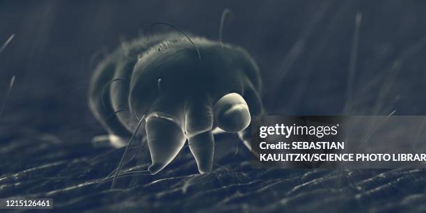 scabies mite on human skin, illustration - scabies stock illustrations
