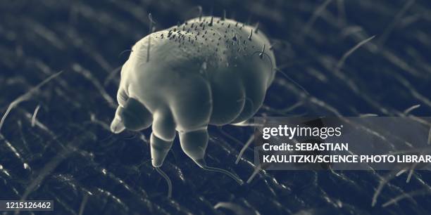 scabies mite on human skin, illustration - dermatology stock illustrations