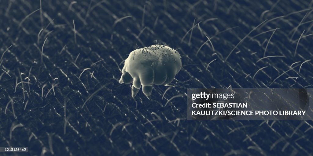 Scabies mite on human skin, illustration