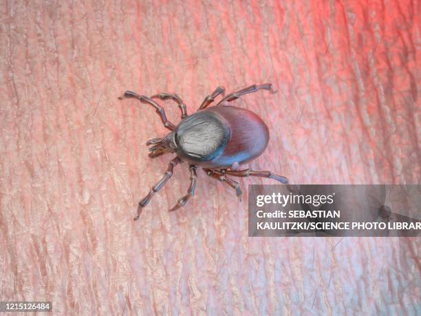 tick on human skin, illustration - bloodsucking stock illustrations