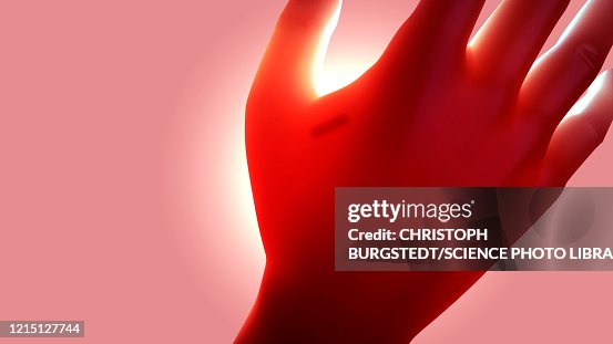 Microchip implanted in human hand, illustration Microchip implanted in human hand, illustration