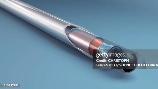illustrations, cliparts, dessins animés et icônes de subdermal microchip implant, illustration - field of empty chairs