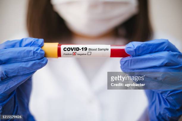 holding test tube with covid-19 - positive emotion stock pictures, royalty-free photos & images