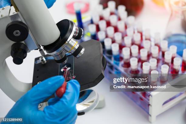 scientist using microscope conducting genetic research of blood sample in laboratory. - globulos rojos humanos fotografías e imágenes de stock