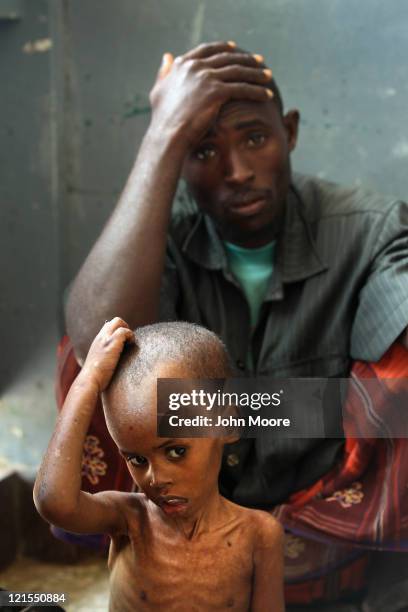 Weak and malnourished, Hassan Ali Musa sits with his father Iisa Ali Musa at the Banadir hospital on August 20, 2011 in Mogadishu, Somalia. The UN...