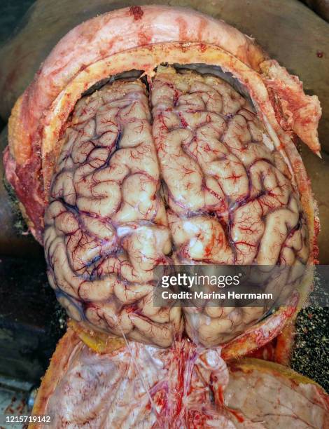 human brain - brain death stock pictures, royalty-free photos & images