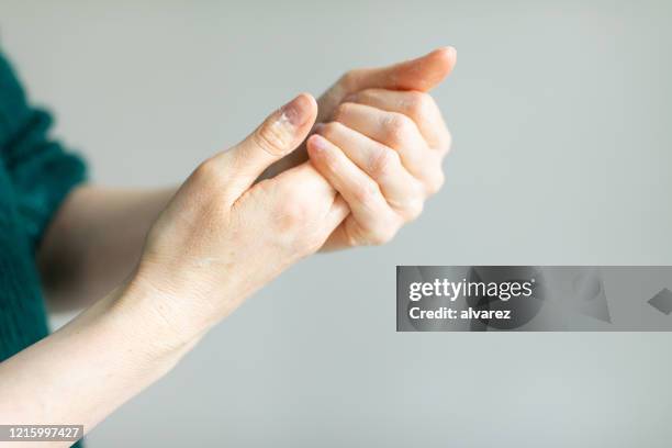 woman applying hand cream to relieve the dry skin caused by hand sanitizer - disinfection stock pictures, royalty-free photos & images