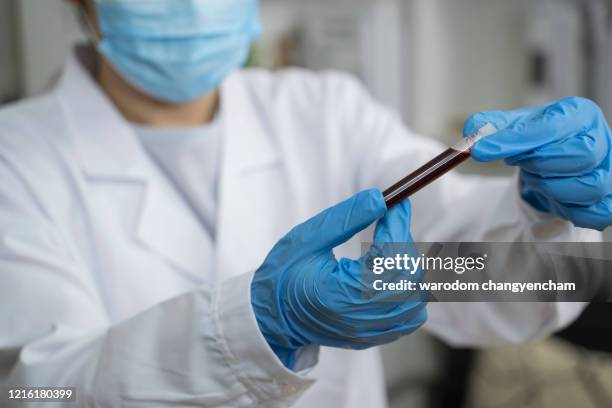 doctor hand taking a blood sample tube of analysis in the lab background. - musical sample fotografías e imágenes de stock