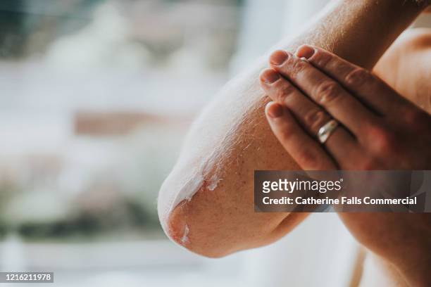 dry skin on elbows - nata fotografías e imágenes de stock