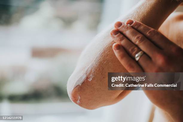 dry skin on elbows - caratteristica della pelle foto e immagini stock