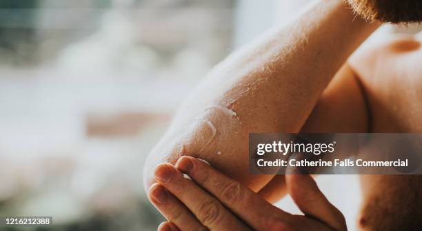dry skin on elbows - peau de fruit photos et images de collection