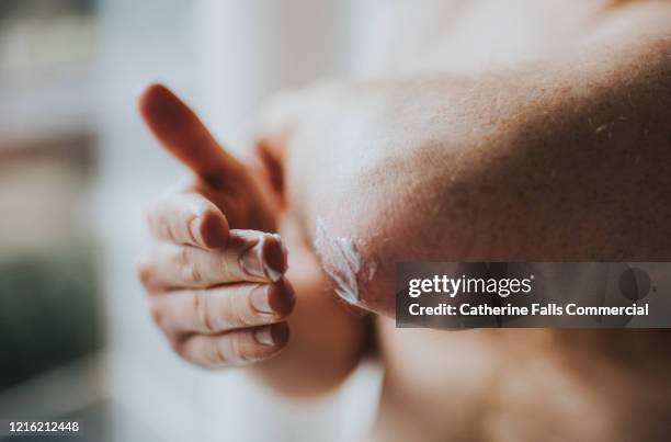 dry skin on elbows - skin cream photos et images de collection