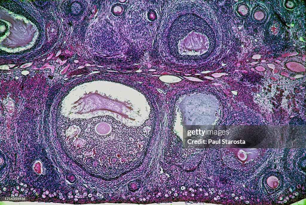 Ovarian follicles at different stages in a rabbit ovary