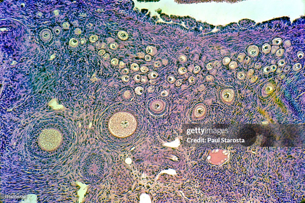 Ovarian follicles at different stages in a rabbit ovary