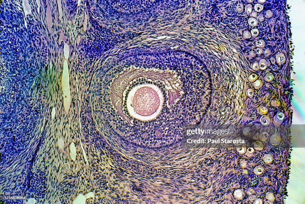 Ovarian follicles at different stages in a rabbit ovary