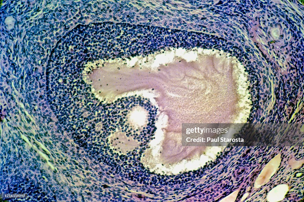 Ovarian follicles in a rabbit ovary