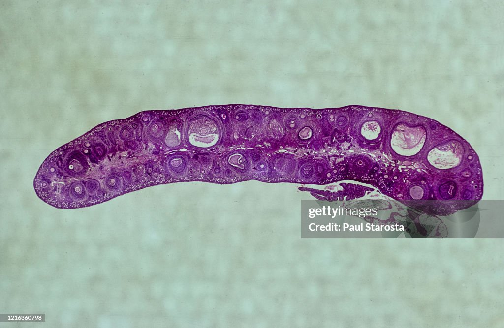Ovarian follicles at different stages in a rabbit ovary